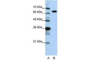 WB Suggested Anti-KARS  Antibody Titration: 0. (KARS antibody  (C-Term))