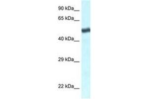 Image no. 1 for anti-Transducin (Beta)-Like 1 X-Linked Receptor 1 (TBL1XR1) (C-Term) antibody (ABIN6747500)