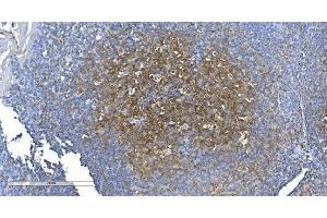 IHC analysis of GCHFR using anti-GCHFR antibody (ABIN7600511). (GCHFR antibody  (AA 2-84))