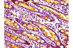 Immunohistochemistry of paraffin-embedded human small intestine tissue using ABIN7142326 at dilution of 1:100 (MPST antibody  (AA 102-208))