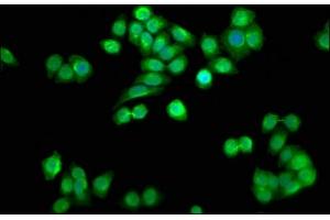 Immunofluorescence staining of PC-3 cells with ABIN7168295 at 1:33, counter-stained with DAPI. (SSU72 antibody  (C-Term))