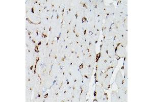 Immunohistochemistry of paraffin-embedded rat heart using APOE Rabbit pAb (ABIN6133561, ABIN6137017, ABIN6137019 and ABIN6213793) at dilution of 1:50 (40x lens).