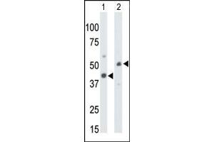 The anti-CKMT1 Pab (ABIN391091 and ABIN2841231) is used in Western blot to detect CKMT1 in mouse colon tissue lysate (Lane 1) and ZR-75-1 cell lysate (Lane 2). (CKMT1 antibody  (N-Term))