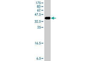 Western Blot detection against Immunogen (35. (CDH23 antibody  (AA 29-114))