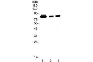Western blot testing of 1) human placenta, 2) rat spleen and 3) mouse spleen tissue lysate with Lactoferrin antibody at 0.