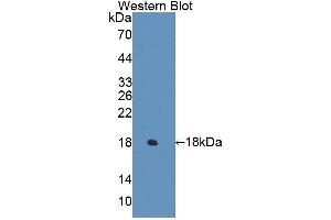 Detection of Recombinant ECRG4, Human using Polyclonal Antibody to Esophageal Cancer Related Gene 4 (ECRG4) (C2orf40 antibody  (AA 32-148))