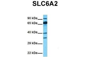 Host:  Rabbit  Target Name:  SLC6A2  Sample Tissue:  Human Fetal Liver  Antibody Dilution:  1. (SLC6A2 antibody  (Middle Region))