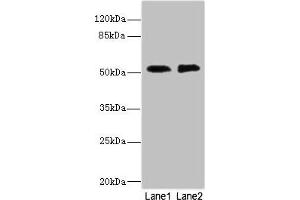Western blot All lanes: TMOD1 antibody at 2. (CIR1 antibody  (AA 1-160))
