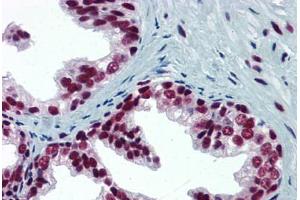 Human Prostate: Formalin-Fixed, Paraffin-Embedded (FFPE) (SP1 antibody  (AA 89-199))