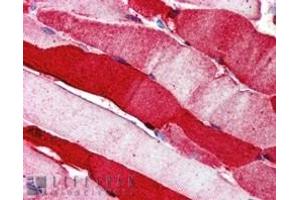 ABIN185150 (5µg/ml) staining of paraffin embedded Human Skeletal Muscle. (MPP5 antibody  (N-Term))