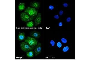 ABIN5539801 Immunofluorescence analysis of paraformaldehyde fixed MCF7 cells, permeabilized with 0. (ESR2 antibody  (AA 417-428))