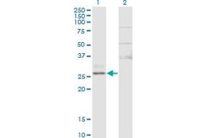 Western Blot analysis of CTRB1 expression in transfected 293T cell line by CTRB1 monoclonal antibody (M02), clone 3C8. (CTRB1 antibody  (AA 101-200))
