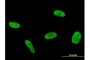 Immunofluorescence of monoclonal antibody to C9orf86 on HeLa cell. (C9orf86 antibody  (AA 1-477))