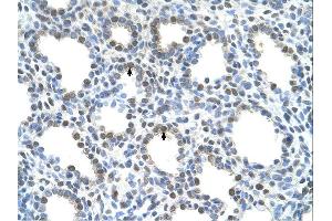 Immunohistochemistry (IHC) image for anti-Solute Carrier Family 15 (H+/Peptide Transporter), Member 4 (SLC15A4) (N-Term) antibody (ABIN310554) (SLC15A4 antibody  (N-Term))