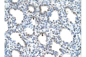 Immunohistochemistry (IHC) image for anti-Solute Carrier Family 15 (H+/Peptide Transporter), Member 4 (SLC15A4) (N-Term) antibody (ABIN2781719) (SLC15A4 antibody  (N-Term))