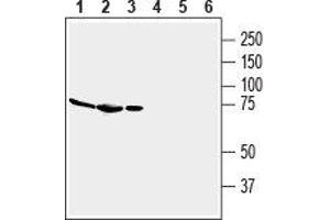 Western blot analysis of mouse brain membranes (lanes 1 and 4), rat brain lysate (lanes 2 and 5) and rat spleen membranes (lanes 3 and 6): - 1-3. (Adenosine A2a Receptor antibody  (2nd Extracellular Loop))