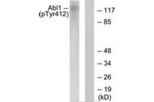 Western blot analysis of extracts from COS7 cells treated with Adriamycin 0. (ABL1 antibody  (pTyr393))