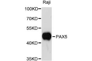 Western blot analysis of extracts of Raji cells, using PAX5 antibody (ABIN1874048) at 1:3000 dilution. (PAX5 antibody)