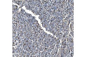 IHC analysis of P4HB using anti-P4HB antibody (ABIN7600075). (P4HB antibody  (AA 146-363))