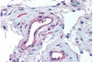 Human Testis, Vessels (formalin-fixed, paraffin-embedded) stained with ADAMTS1 antibody ABIN625843 at 5 ug/ml followed by biotinylated goat anti-rabbit IgG secondary antibody ABIN481713, alkaline phosphatase-streptavidin and chromogen. (ADAMTS1 antibody  (N-Term))