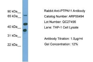 WB Suggested Anti-PTPN11  Antibody Titration: 0. (PTPN11 antibody  (N-Term))