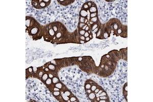 Immunohistochemical staining of human rectum with MKS1 polyclonal antibody  strong cytoplasmic positivity in glandular cells. (MKS1 antibody)