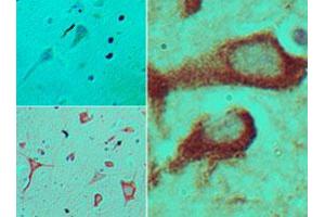 Immunohistochemical analysis of TICAM2 in formalin-fixed, paraffin-embedded human brain tissue using an isotype control (top left) and TICAM2 polyclonal antibody  (bottom left, right) at 5 ug/mL .