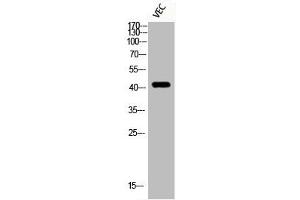 Western Blot analysis of VEC cells using Phospho-HDAC8 (S39) Polyclonal Antibody (HDAC8 antibody  (pSer39))