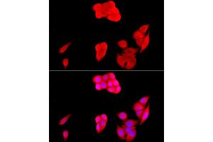 Immunofluorescence analysis of HeLa cells using [KO Validated] SIRT1 Rabbit pAb (ABIN7270322) at dilution of 1:200 (40x lens).