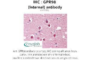 Image no. 2 for anti-G Protein-Coupled Receptor 98 (Gpr98) (Internal Region) antibody (ABIN1735202) (Gpr98 antibody  (Internal Region))