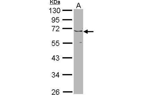 JMJD6 antibody  (Center)