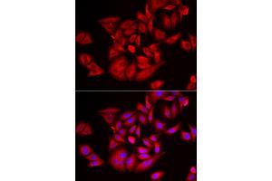 Immunofluorescence analysis of U2OS cells using TLK2 antibody (ABIN5974098). (TLK2 antibody)