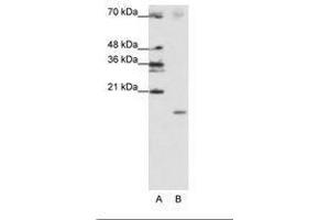 Image no. 2 for anti-Signal Recognition Particle 19kDa (SRP19) (C-Term) antibody (ABIN202029) (SRP19 antibody  (C-Term))