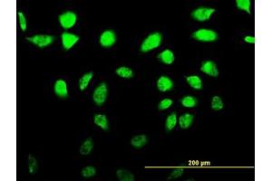 Image no. 1 for anti-A Kinase (PRKA) Anchor Protein 17A (AKAP17A) (AA 53-157) antibody (ABIN599035) (SFRS17A antibody  (AA 53-157))