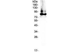 Western blot testing of human plasma lysate with Prothrombin antibody at 0.