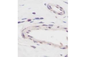 Image no. 5 for anti-Vascular Endothelial Growth Factor A (VEGFA) antibody (ABIN465469) (VEGFA antibody)