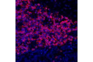 Immunofluorescence (IF) image for anti-CD3 epsilon (CD3E) (AA 157-207) antibody (ABIN7454035) (Recombinant CD3 epsilon antibody  (AA 157-207))