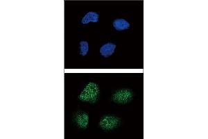 Confocal immunofluorescent analysis of Neurogenin3 Antibody (N-term) (ABIN388770 and ABIN2839081) with NCI- cell followed by Alexa Fluor 488-conjugated goat anti-rabbit lgG (green). (Neurogenin 3 antibody  (N-Term))