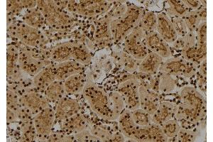 ABIN6261828 and ABIN6274011 at 1/100 staining Rat kidney tissue by IHC-P.