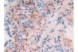 Immunohistochemistry (IHC) image for anti-Alcohol Dehydrogenase 1 (Class I) (ADH1) (AA 169-370) antibody (ABIN7432379)
