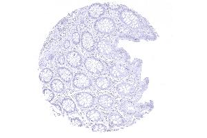 Colon descendens mucosa (Recombinant MSH6 antibody  (AA 1-100))