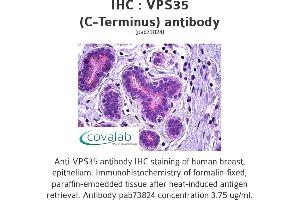Image no. 1 for anti-Vacuolar Protein Sorting 35 (VPS35) (C-Term) antibody (ABIN1740787)