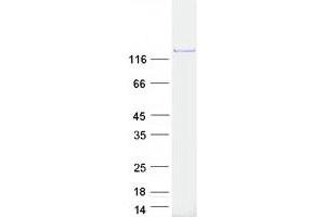 Validation with Western Blot (PFAS Protein (Myc-DYKDDDDK Tag))