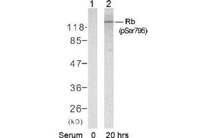 Image no. 2 for anti-Retinoblastoma 1 (RB1) (pSer795) antibody (ABIN196838) (Retinoblastoma 1 antibody  (pSer795))