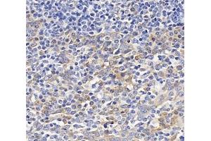 Immunohistochemistry analysis of paraffin-embedded human tonsil using,OAS3 (ABIN7072846) at dilution of 1: 4000 (OAS3 antibody)