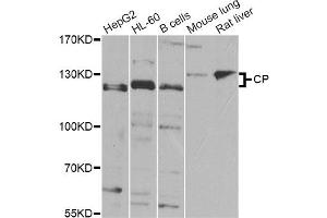 Western blot analysis of extracts of various cell lines, using CP Antibody (ABIN5974460) at 1/1000 dilution. (Ceruloplasmin antibody)