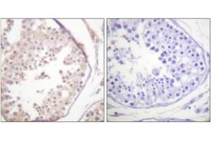 Immunohistochemistry analysis of paraffin-embedded human testis tissue, using RAD52 (Ab-104) Antibody.