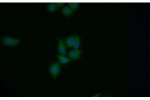 Detection of MGEA5 in Human MCF7 cell using Polyclonal Antibody to Meningioma Expressed Antigen 5 (MGEA5) (MGEA5 antibody  (AA 6-240))