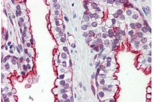 Human Prostate (formalin-fixed, paraffin-embedded) stained with CLU antibody ABIN364331 at 10 ug/ml followed by biotinylated anti-mouse IgG secondary antibody ABIN481714, alkaline phosphatase-streptavidin and chromogen. (Clusterin antibody  (AA 1-333))