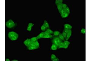 Immunofluorescent analysis of PC-3 cells using ABIN7143886 at dilution of 1:100 and Alexa Fluor 488-congugated AffiniPure Goat Anti-Rabbit IgG(H+L) (ALKBH3 antibody  (AA 1-170))